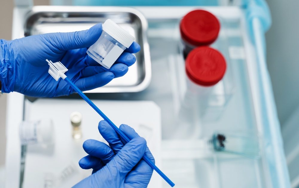 Gynecological,Cytology,Pap,Smear,Test,And,Cytobrush,In,Hands,Of
